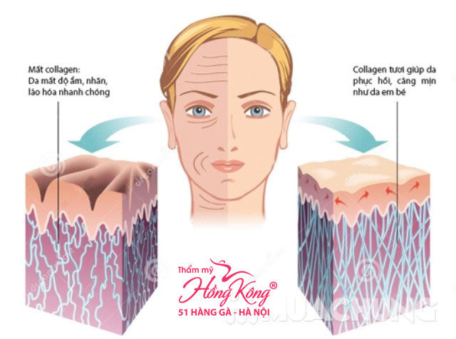 Collagen tự nhiên là một loại protein, chiếm khoảng 70 – 80% cấu trúc da