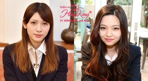 Ở châu Á hiện nay chỉ có Nhật Bản thích vẻ đẹp của khuôn mặt tròn bầu bĩnh. Hai nữ sinh Yamamoto (trái) và Sakurai Yuu (phải) hiện đang là gương mặt nổi tiếng và được yêu thích ở đây một phần bởi họ sở hữu đặc điểm khuôn mặt này. 