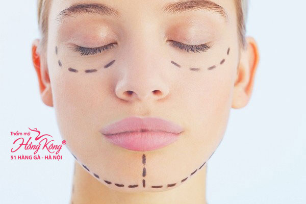 Gọt mặt là phương pháp phẫu thuật cắt gọt các phần xương mặt