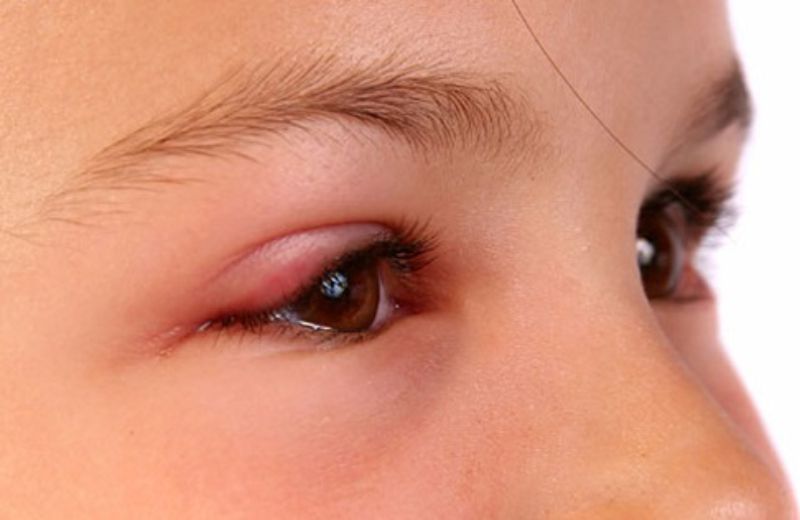 Sau phun xăm, vùng mí mắt thường bị đau từ 2-3 ngày
